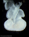A human embryonic heart
