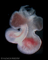 A human embryonic heart