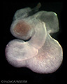 A human embryonic heart