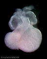 A human embryonic heart