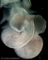 A human embryonic heart