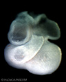 A human embryonic heart