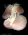 A human embryonic heart