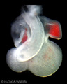 A human embryonic heart