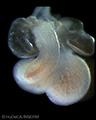 A human embryonic heart