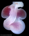 A human embryonic heart