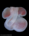 A human embryonic heart