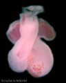 A human embryonic heart