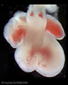 A human embryonic heart