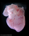 A human embryonic heart