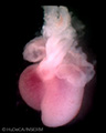 A human embryonic heart