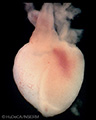 A human embryonic heart
