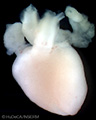 A human embryonic heart