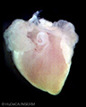 A human embryonic heart