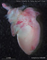 A human fetal heart