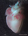 A human fetal heart