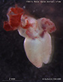 A human fetal heart