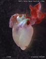 A human fetal heart