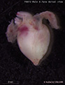 A human fetal heart