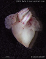 A human fetal heart