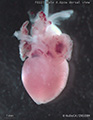 A human fetal heart