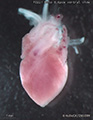 A human fetal heart