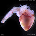 A human fetal heart
