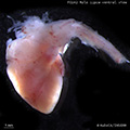 A human fetal heart