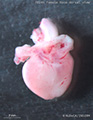 A human fetal heart