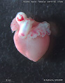 A human fetal heart