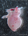 A human fetal heart