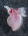 A human fetal heart