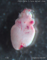 A human fetal heart