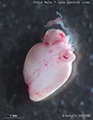 A human fetal heart