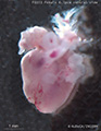 A human fetal heart