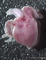 A human fetal heart