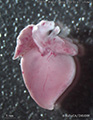 A human fetal heart