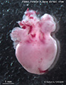 A human fetal heart