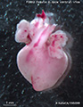A human fetal heart