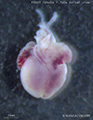 A human fetal heart