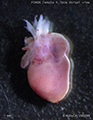 A human fetal heart