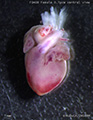 A human fetal heart