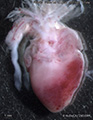 A human fetal heart
