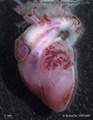 A human fetal heart