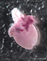 A human fetal heart