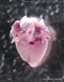 A human fetal heart