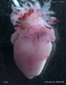 A human fetal heart