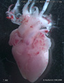 A human fetal heart