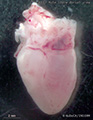 A human fetal heart