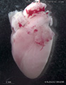 A human fetal heart